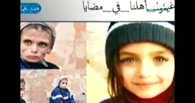 بالفيديو حقيقة صور المجاعة في مضايا - سوريا