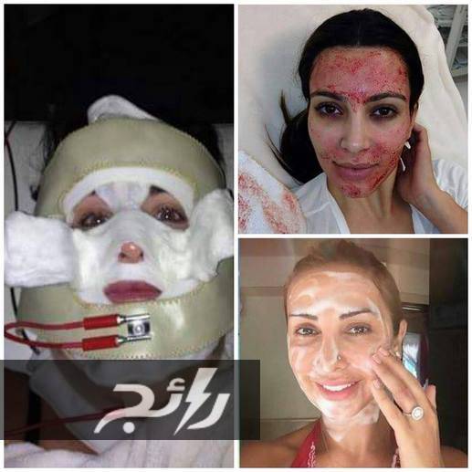 صور مرعبة وصادمة لنجمات العالم يعتنين بجمالهن في مراكز التجميل...مستحيل أن تتعرف عليهن!