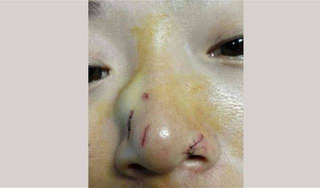 بالفيديو.. ثعبان يهاجم فتاة بسبب قبلة