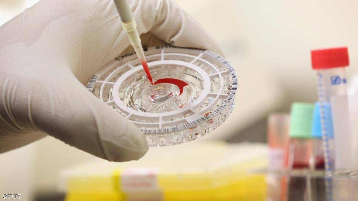 اتفاق بقيمة 5 ملايين دولار لإنتاج لقاح لإيبولا