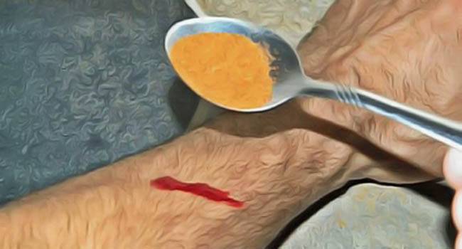 كيف توقفون النزيف في 15 ثانية فقط ؟!