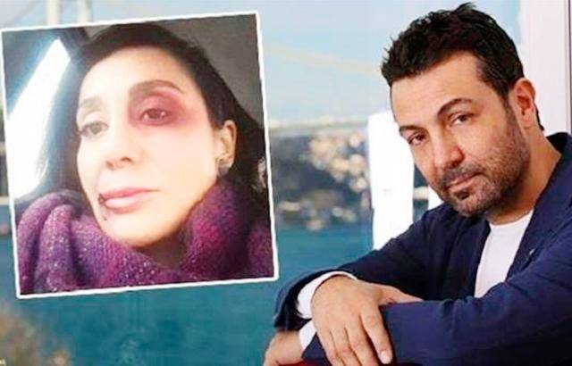بالصّور: ممثل مشهور يعنف حبيبته.. فمن هو؟