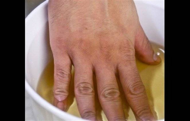 ماذا يفعل وضع اليد في الخل والماء 3 مرات يومياً... لن تصدقوا النتيجة المثالية