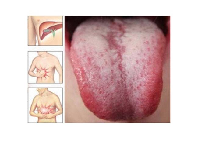 علامات وعوارض تدل على أن الجسم مليء بالسموم