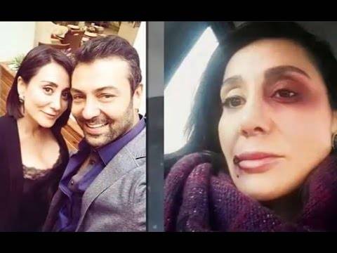 بعد اتهامه بضرب خطيبته.. هكذا عُوقب النجم التركي "أسمر"
