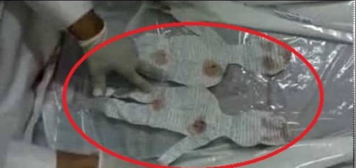 بالفيديو  استخراج سحر من المقابر شاهد ماذا وجدوا بداخله!