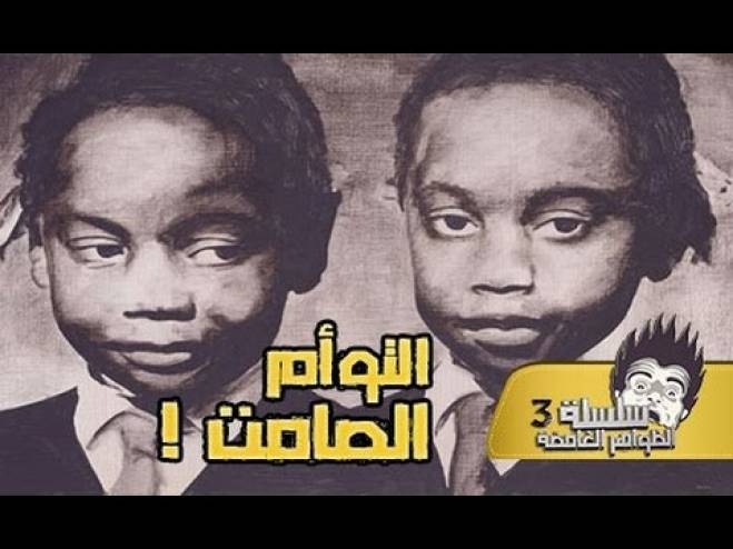 بالفيديو- الشقيقتان جيبونز التوأم الأكثر غموضاً في التاريخ !