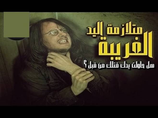 بالفيديو- متلازمة اليد الغريبة.. هل حاولت يدك قتلك من قبل؟!