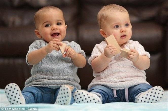 بالصور - مايلا وانايا: قصة توأم لا يظهر سوى مرة بين كل مليون!