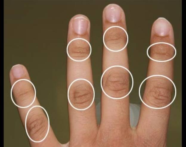 هل تساءلت يوماً ما هي الخطوط المتجمعة على اصابعك؟