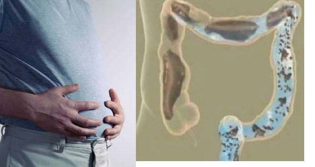 نصائح عليكم إتباعها من أجل تخفيف الإمساك وانتفاخ البطن في غضون بضع دقائق