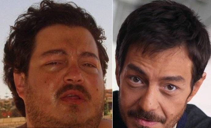 صور صادمة - مشاهير تغيرت أشكالهم أثناء معاناتهم من أمراض خطيرة