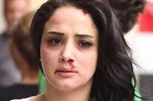 بالفيديو أول تصريح للفنانة السورية رشا إبراهيم بعد نجاتها من التفجير!