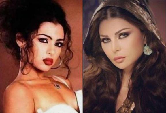 صور لا تُصدّق| هكذا أصبحت وجوه 6 من اشهر الفنانات العربيّات بسبب عمليات التجميل!