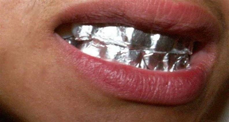تبييض الاسنان باستخدام اوراق الالمنيوم وإليكم الطريقة