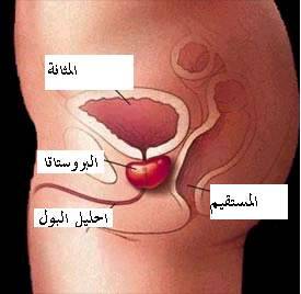ملف متكامل عن تضخم البروستاتا الحميد  سبل علاجه و تاثيره على القدرة الجنسية للرجل