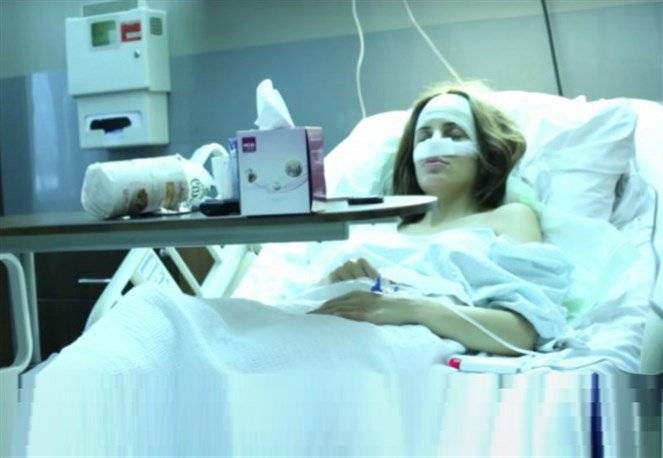 بالصور-  دومينيك حوراني تجري عملية تجميل لأنفها مباشرة على الهواء!