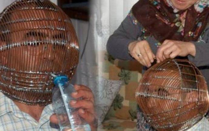 زوجة تجبر زوجها على العيش ورأسه بقفص حديدي ...