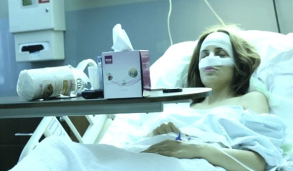 اجراء عملية تجميل لأنف دومينيك مباشرة على الشاشة