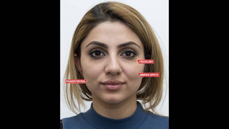 التقطت 50 صورة "سيلفي" بشكل يومي فدفع وجهها الثمن
