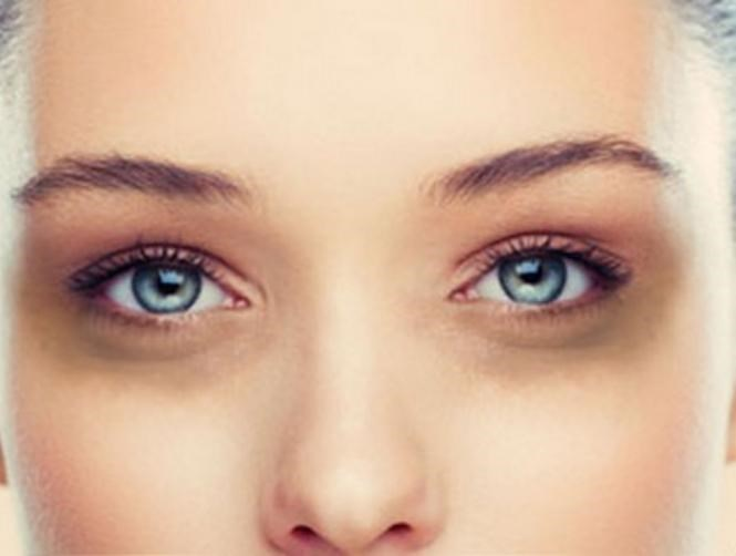 عادات تسبّب الهالات السوداء