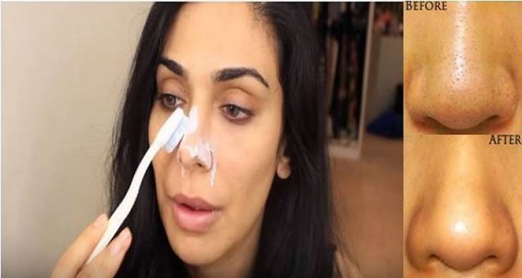 فيديو: عند فرك الأنف بمعجون الأسنان.. شاهدي النتائج المذهلة !‎