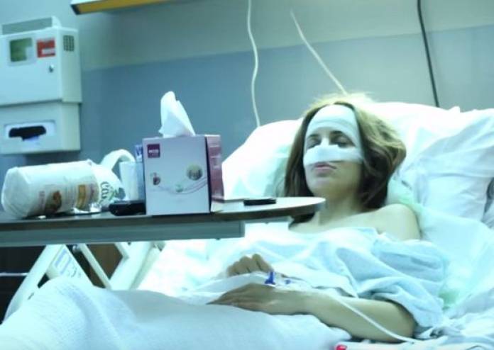 فيديو: فنّانة لبنانية مشهورة تجري عملية لأنفها أمام الكاميرات