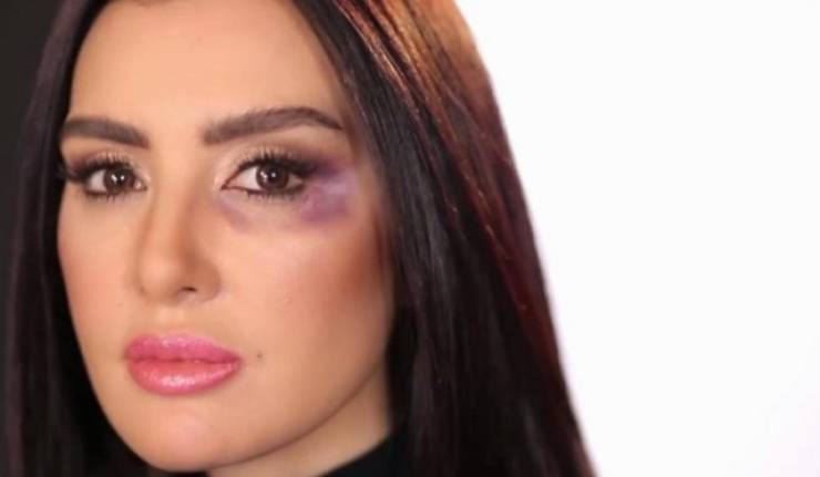 من السبب في إصابة ميساء مغربي؟