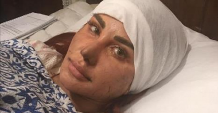 ماذا جرى لجيني إسبر؟ وما سبب هذ الجروح على وجهها؟