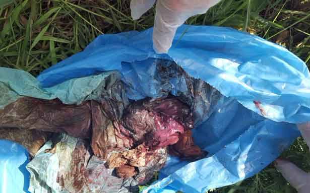 نفايات أعضاء بشرية في طرابلس
و«الصحّة» تواصل حملتها في صيدا والبقاع