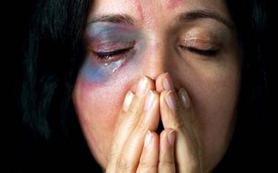 امرأة تقاضي زوجها لضربها.. والمتهم يدعي استيلاءها على 6 ملايين