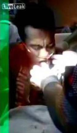 بالفيديو المرعب.. لحظة إخراج سمكة من بلعوم صياد