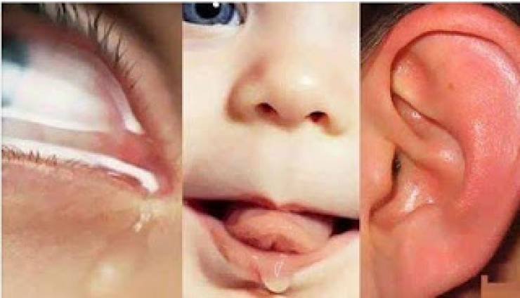 هل تعلم لماذا ماء العين مالحاً !! ﻭماء ﺍلأﺫﻥ مراً وماء الفم عذباً ؟ لن تصدق السبب