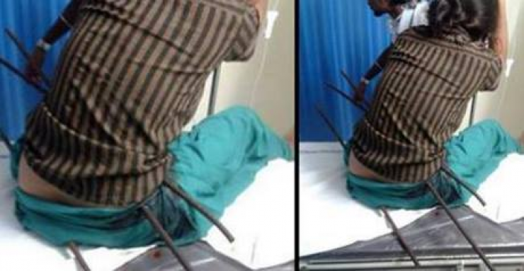 مراهقة سقطت على أسياخ حديدة تنجو بأعجوبة لا تصدق!