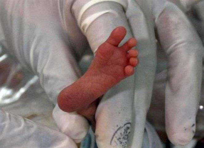 ماتت.. لكنها أنجبت "معجزة" بعد 55 يوما!