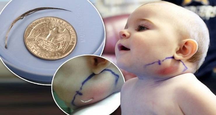 بالفيديو.. ام تكتشف ما لم تتوقعه في خد طفلتها! ستشعر بالصدمة!