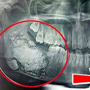 صور: وجدوا في لثتها ما لا يصدقه العقل!