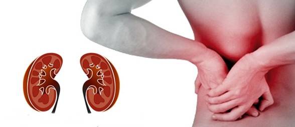 ابتعد عن العادات اليومية التي تسبب الفشل الكلوي، فما هي؟