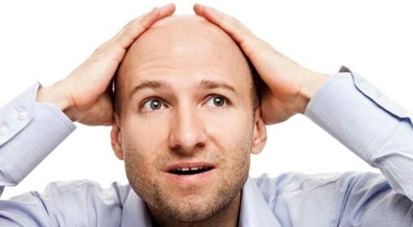 للرجال فقط.. وداعا للصلع
