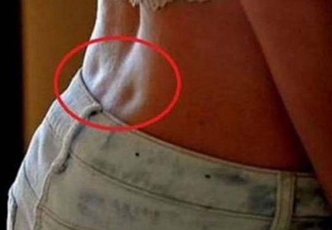 ماذا يعني وجود هذه الغمازات أسفل الظهر؟