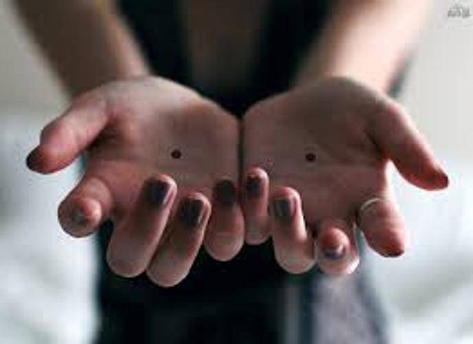 لماذا يجب استدعاء الشرطة بمجرد رؤية 