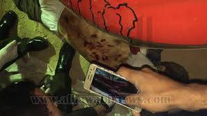 بالصورة طعن طيار مصري  35 طعنة بسكين في ظهره