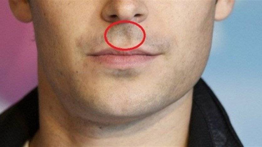 ما سرّ الفجوة الموجودة بين الأنف والشفة العليا؟