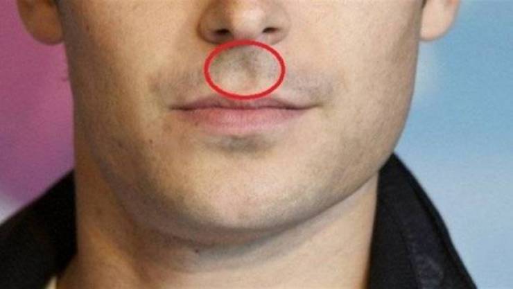 سرّ الفجوة الموجودة بين الأنف والشفة العليا!