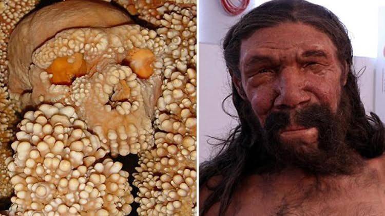 إعادة تشكيل وجه رجل عمره 150 ألف عام