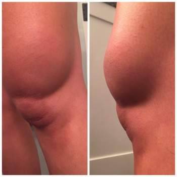 بالصور.. كلوي كارداشيان تنجو من الموت؟