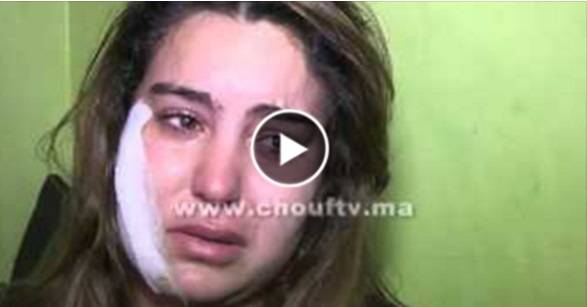 بالفيديو: زوج يشوه وجه زوجته والسبب غريب وجنونى