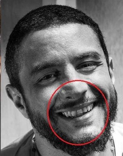 15 صورة لنجوم تفضح عيوبهم.. الصورة رقم 1 ستصدمك