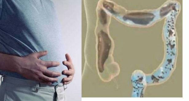 نصائح عليكم إتباعها من أجل تخفيف الإمساك وانتفاخ البطن في غضون بضع دقائق