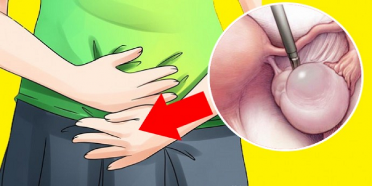 علامات يومية تتجاهلها المرأة تدل على "تكيس بالمبايض"!